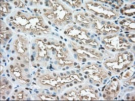 Monoclonal Mouse anti-Human PFN1 / Profilin 1 Antibody (clone OTI1D5, IHC, IF, WB)