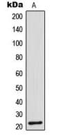 PathPlus™ CTSG / Cathepsin G Antibody (Internal)