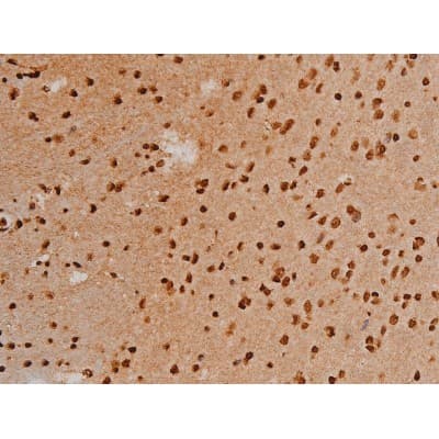 Polyclonal Rabbit anti-Human EZR / Ezrin Antibody (phospho-Tyr353, IF, WB)