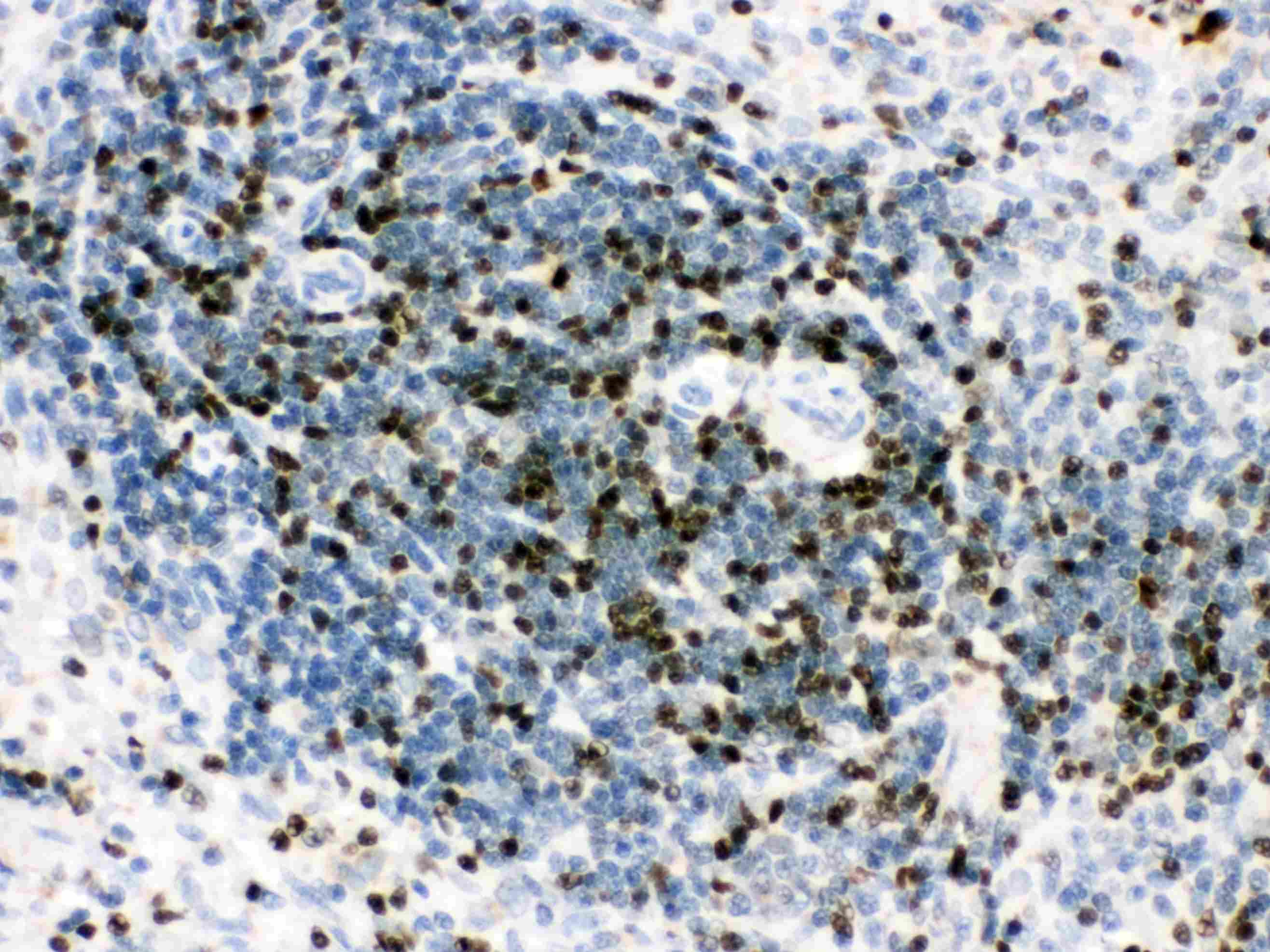 Polyclonal Rabbit anti-Human RUNX3 Antibody (IHC, WB)