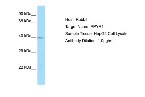 NPY4R / PPYR1 Antibody (N-Terminus)