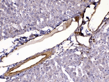 FLT4 / VEGFR3 Antibody