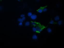 Monoclonal Mouse anti-Human TRIM44 Antibody (clone OTI1E10, IHC, IF, WB)