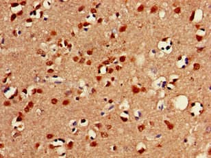 FOXC2 Antibody