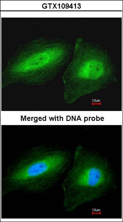 Polyclonal Rabbit anti-Human CCDC83 Antibody (aa67-276, IHC, WB)