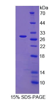 Human SNX13 Protein (Recombinant His)