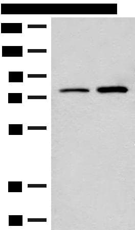 Polyclonal Rabbit anti-Human THOP1 / Thimet Oligopeptidase Antibody (IHC, WB)