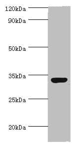 Polyclonal Rabbit anti-Human CRD / CRX Antibody (aa120-285, IHC, WB)
