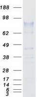 Human ZP2 Protein (Recombinant Myc-DDK (Flag))