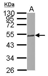 TUBB4B / Tubulin Beta 4B Antibody (Internal)