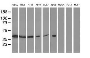 ACAT2 Antibody (clone OTI3A8)