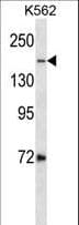 TOP2A / Topoisomerase II Alpha Antibody (aa1434-1461)