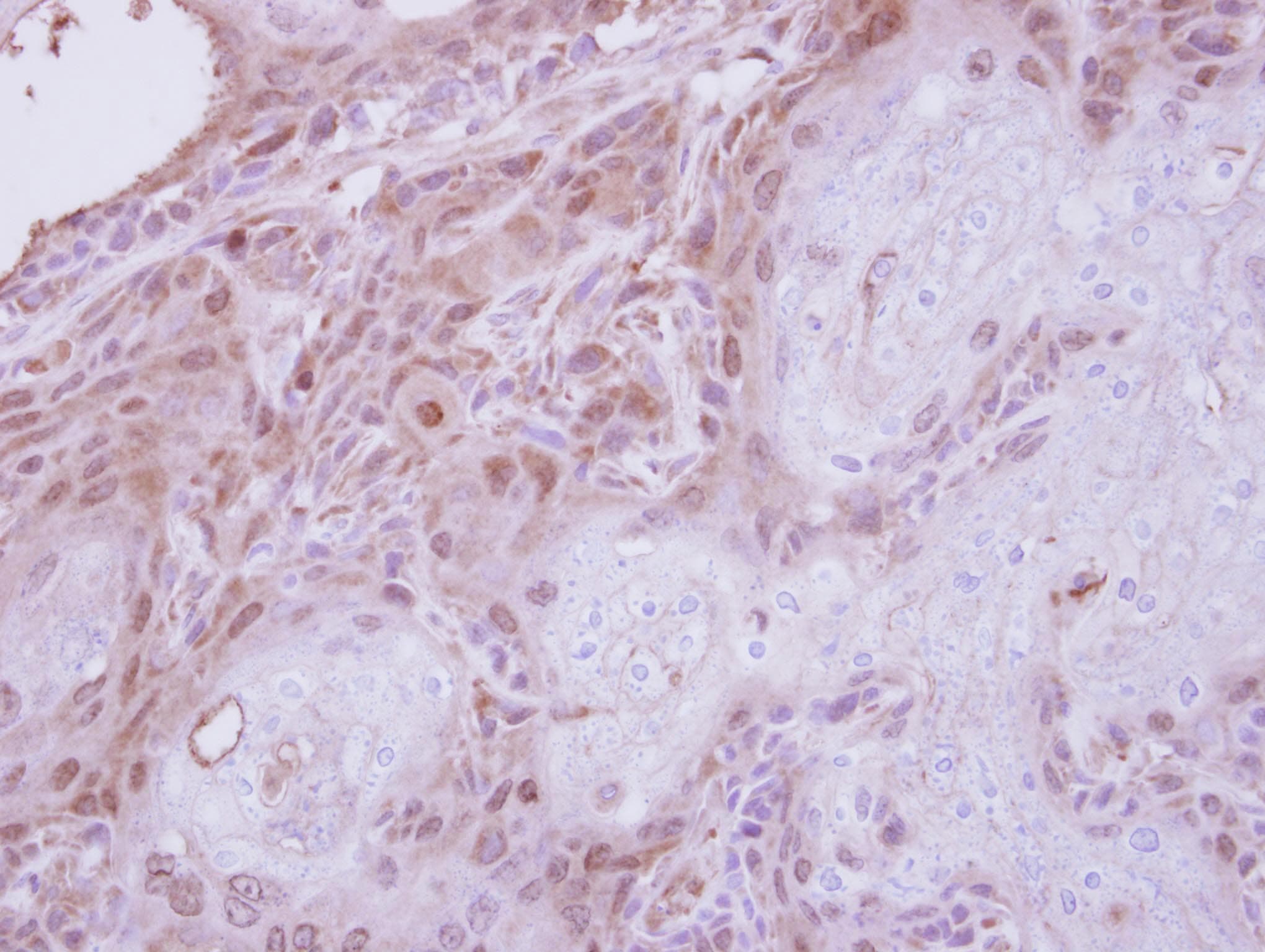 TPRKB Antibody (aa1-175)