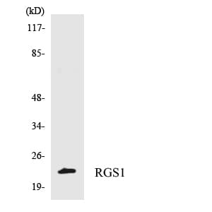 IHC-plus™ Polyclonal Rabbit anti-Human RGS1 Antibody (aa102-151, IHC, WB)