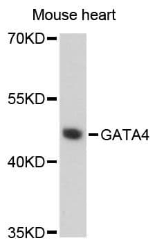 Polyclonal Rabbit anti-Human GATA4 Antibody (WB)