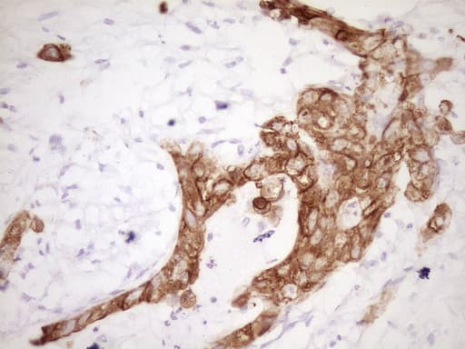 Monoclonal Mouse anti-Human KRT19 / CK19 / Cytokeratin 19 Antibody (clone OTI6A8, aa240-390, IHC, WB)