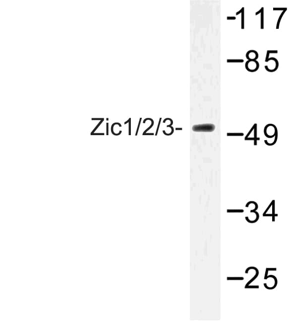 ZIC1+2+3 Antibody (Asp348)