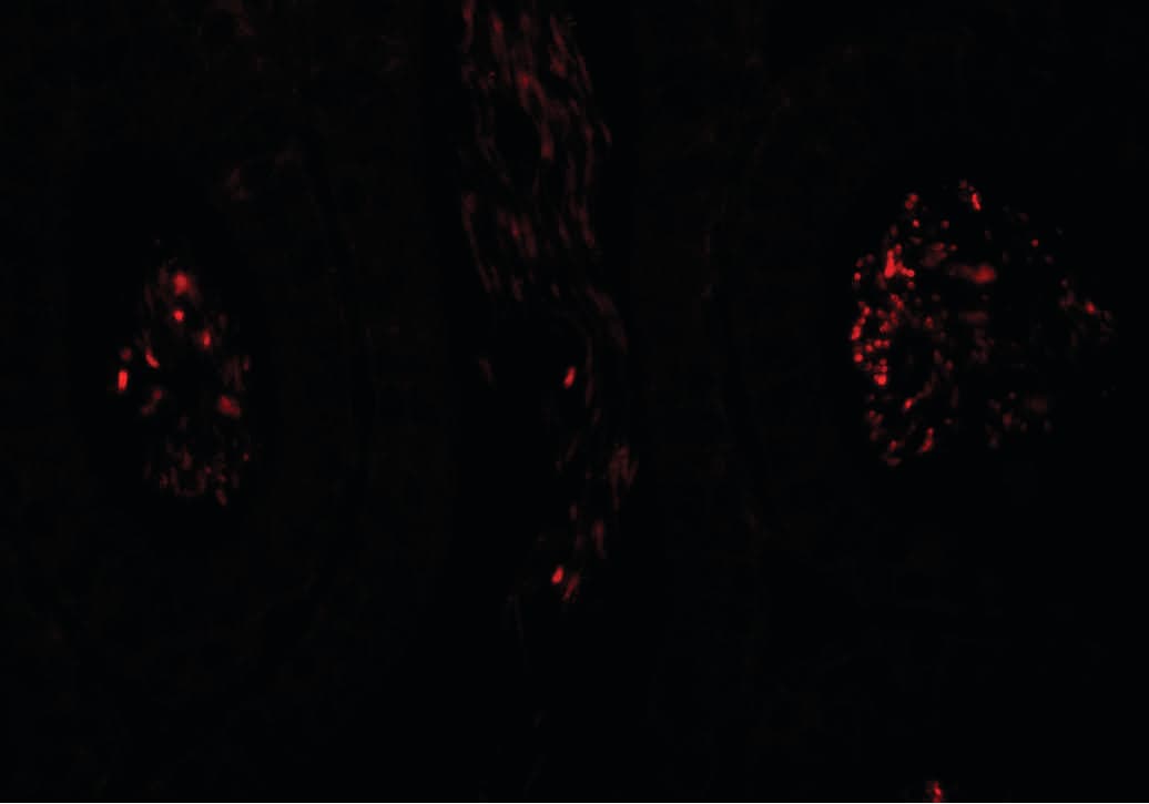 SP-2 / SPATA1 Antibody