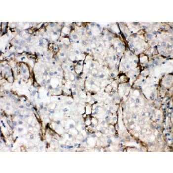 Polyclonal Rabbit anti-Mouse SLC10A1 / NTCP Antibody (aa296-336, IHC, WB)