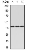 C5AR1 / CD88 / C5a Receptor Antibody (N-Terminus)