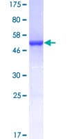 Human RAN Protein (Recombinant GST)