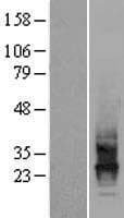 Human CD63 Protein (Over-Expression Lysate Myc-DDK (Flag))