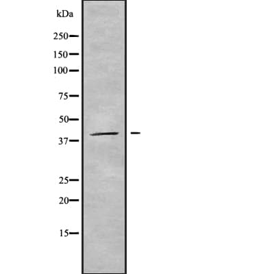 KIR2DL5A / KIR2DL5 Antibody