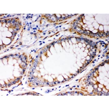 BAK1 / BAK Antibody (aa22-211)