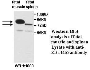 ZBTB16 / PLZF Antibody (aa389-658)