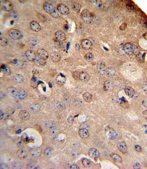 SLC8A1 / NCX1 Antibody (aa296-325)
