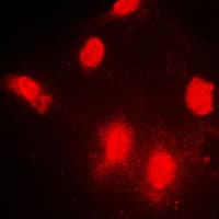 Polyclonal Rabbit anti-Human IPPK Antibody (N-Terminus, IHC, IF, WB)