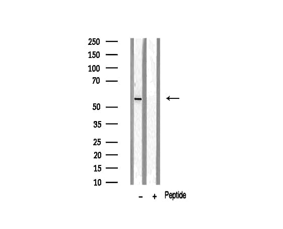 CYP2U1 Antibody