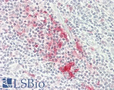 IHC-plus™ TXN / Thioredoxin / TRX Antibody (aa 2-105)