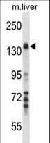 MAP3K1 / MEKK1 Antibody (aa1194-1221)