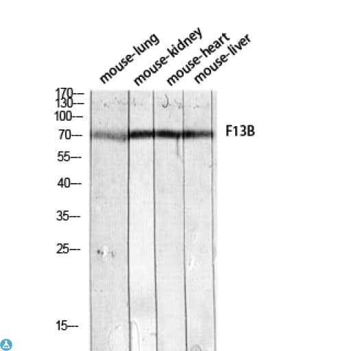 F13B / TGase Antibody