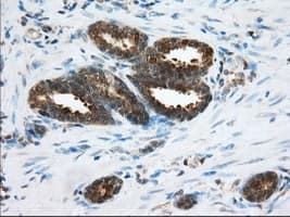 ACAT2 Antibody (clone OTI3C9)