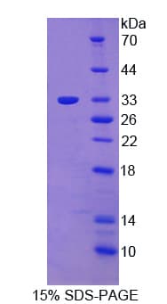 Human PTK6 / BRK Protein (Recombinant His-T7)