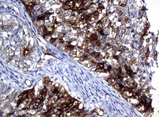 FOLH1 / PSMA Antibody (clone UMAB25, Carrier-free)