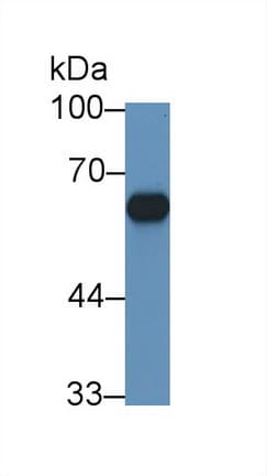 CYP11B1 Antibody (aa1-498)