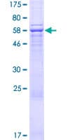 Human AMZ2 Protein (Recombinant GST)