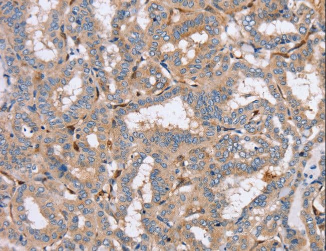 PPM1F Antibody