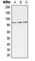 Polyclonal Rabbit anti-Human TLK1 Antibody (phospho-Ser743, WB)