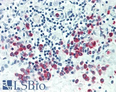 Lymphotoxin-Beta / LTB Antibody (aa58-304)