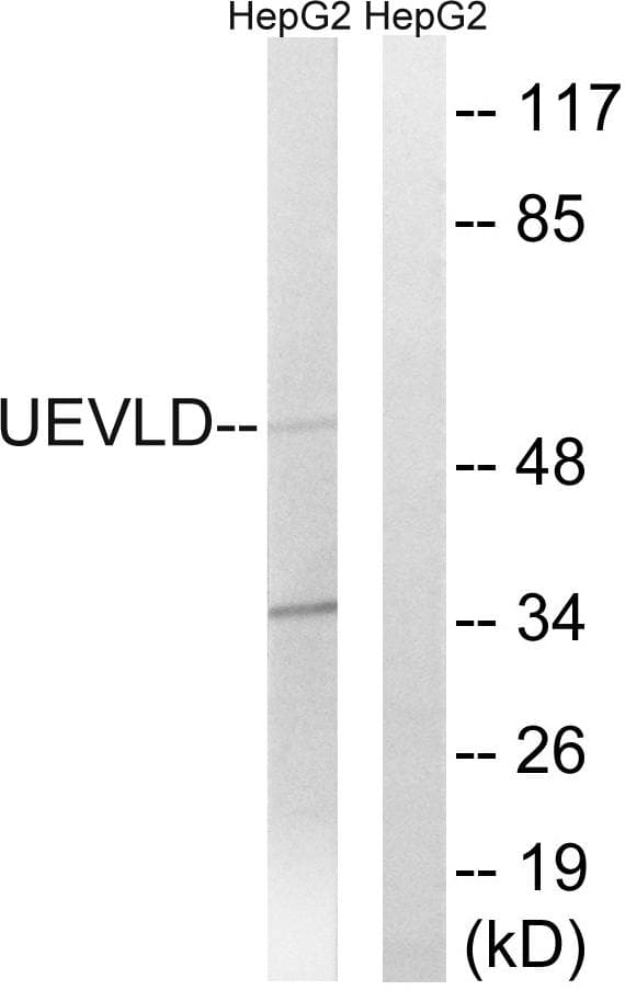 Polyclonal Rabbit anti-Human UEVLD Antibody (IHC, WB)