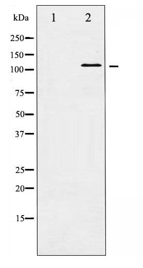 Polyclonal Rabbit anti-Human HDAC5 Antibody (phospho-Ser498, IHC, WB)