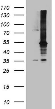 Monoclonal Mouse anti-Human MAP3K8 / TPL2 Antibody (clone OTI2E3, aa277-461, IHC, WB)