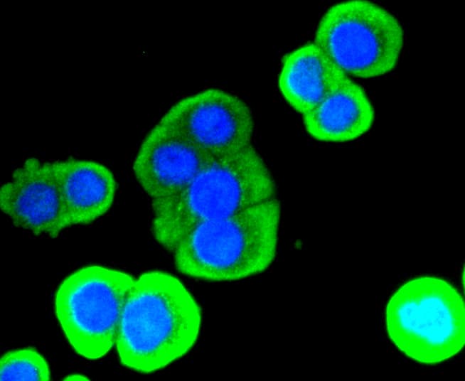 LYZ / Lysozyme Antibody