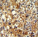 ACTN1 Antibody (aa1-30)