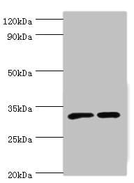 Polyclonal Rabbit anti-Human SLC25A15 / ORNT1 Antibody (aa1-301, IHC, WB)