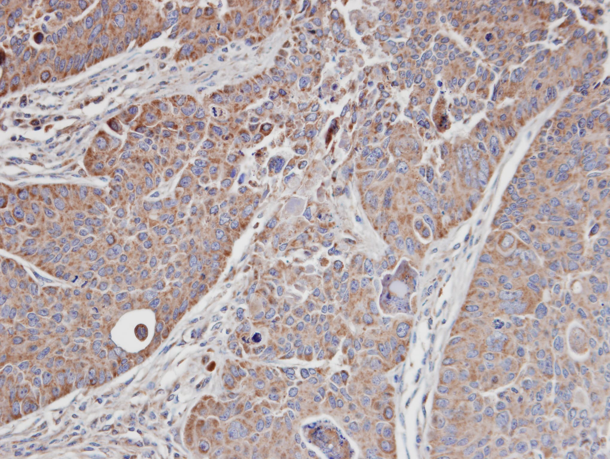 CDC42BPA / MRCK Antibody (aa373-564)